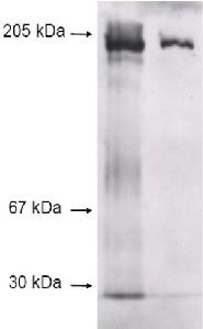 A1i3 | alpha-1-inhibitor 3  in the group Antibodies Human Cell Biology / Other proteins at Agrisera AB (Antibodies for research) (AS07 272)